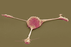 Cell Biology Images Drucke: Fibroblast, SEM