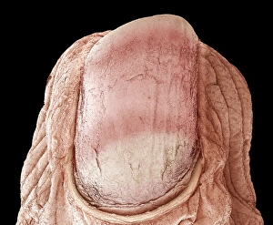 Scanning Electron Microscope Photos Drucke: Fingernail, SEM