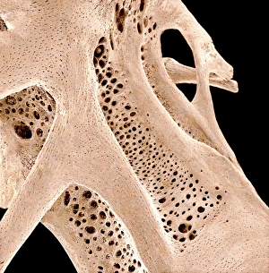 Cancellous Bone Structure Drucke: Fish bone, SEM C015 / 7923