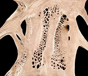 Fischknochen, SEM C015/8067