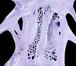 Cancellous Bone Structure Drucke: Fish bone, SEM C015 / 8068