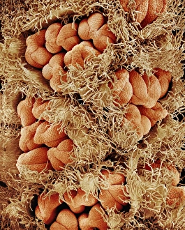 Scanning Electron Microscopy Of Flowers Drucke: Flower buds, SEM