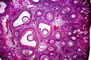 Female Reproductive System Anatomy Drucke: Follicles in a human ovary, micrograph