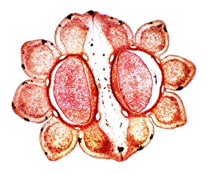 Light Microscopy Images Drucke: Fools parsley fruit, light micrograph