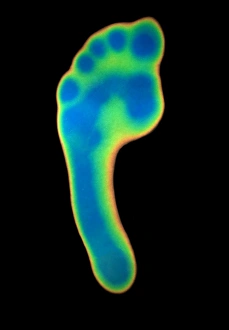 Thermography Images Drucke: Foot, thermogram