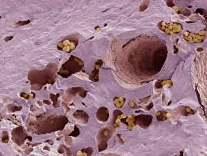 Scanning Electron Microscope Images Drucke: Fossilised compact bone, SEM