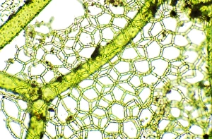 Freshwater Algae Drucke: Freshwater alga, light micrograph