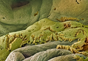 Gallenblatträume, SEM