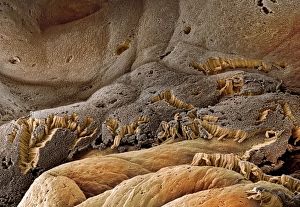 Gallenblasenoberfläche, SEM