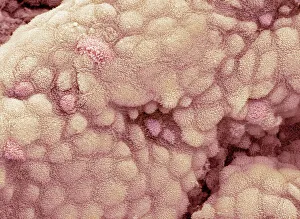 SEM Drucke: Nierenblasenoberfläche, SEM