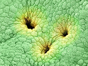 Nierenblasenoberfläche, SEM C015/9611