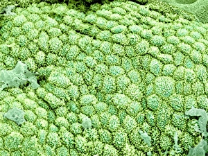 Coloured SEM Images Drucke: Gallbladder surface, SEM C015 / 9612
