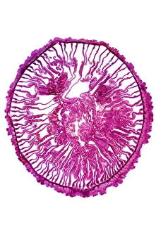 Light Micrograph Drucke: Gem anemone, light micrograph