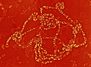 Chromosome Structure Drucke: Giant chromosome, light micrograph
