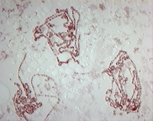 Bilder Datiert 2. März 2012: Riesenchromosomen, Lichtmikroskopbild
