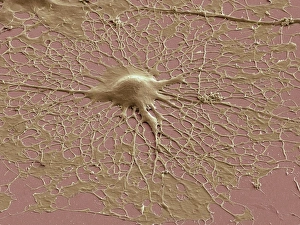 Cerebral Cortex Structure Drucke: Glial cell, SEM