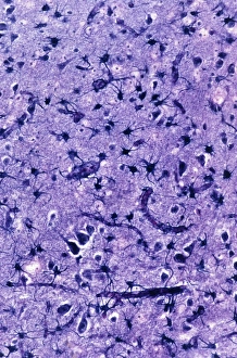 Glial Cells Drucke: Glial cells, light micrograph