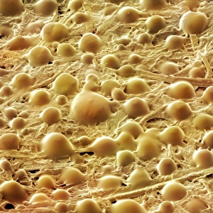 Drucke von Zusammenfassung der Klebstoffe, die für das Klebeband verwendet werden, Farbliche Rastertonenmikroskopie (SEM) Bilder Datiert 2010 April: Kleber auf einer wiederhaltsamen Klebezettelhaftung, SEM
