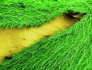 Scanning Electron Microscopy Of Flowers Drucke: Gorse flower bud, SEM