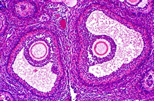 Drucke von Entwickelnde Graafsche Follikel entwickeln sich in der Eierstöng mit zwei Bildern von entwicklungsfähigen Graafschen Follikeln Bilder Datiert 2005 Dezember: Gräfliche Follikel, Lichtmikroskop
