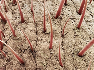 Coloured SEM Micrograph Drucke: Hairs on the upper lip, SEM
