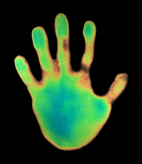 Thermography Images Drucke: Hand, thermogram