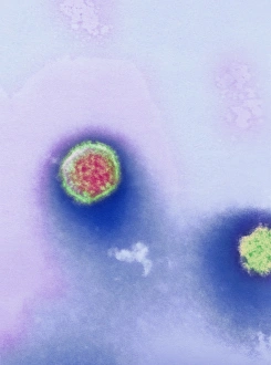 Bilder Datiert 5. Februar 2002: Hantavirus