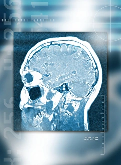 Human Brain Structure Drucke: Head, side view, MRI scan