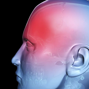 Headache Pain Drucke: Headache, conceptual artwork