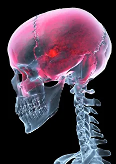 Bilder Datiert 2008: Schmerz, Radiographie Kunstwerk