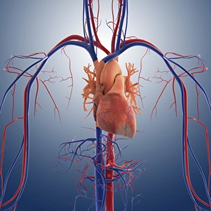 Cardiovascular System Illustration Drucke: Heart attack, artwork C016 / 2894