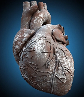 Blood Vessel Illustration Drucke: Heart of stone