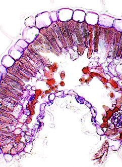 Drought Resistant Plants Drucke: Heather leaf, light micrograph