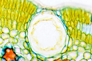 Drought Resistant Plants Drucke: Heather leaf stomata, light micrograph