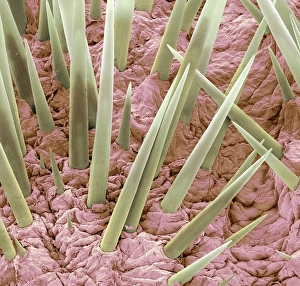 Drucke von Erdbeerenstacheln im Farbenschlüssel des Elektronenmikroskops (SEM). Eine Stachel ist eine modifizierte Haarstruktur aus dem Proteins keratin Bilder Datiert 2010 August: Dornhaaren von Eichhörnchen, SEM