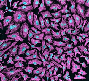 HeLa Cells Drucke: HeLa cells, light micrograph C013 / 4773
