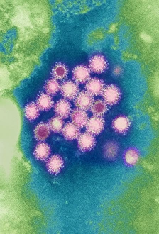 Coloured TEM Images Drucke: Hepatitis B viruses