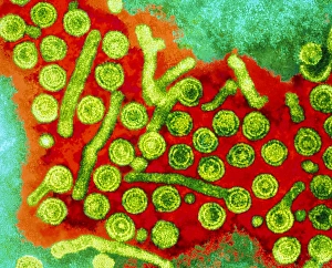 Drucke von Hepatitis-B-Viren: Farbige Übertragungselektronenmikroskopie (TEM) von Hepatitis B-Viren (große grüne Kreise), eine Ursache für Leberentzündungen Bilder Datiert 2002 September: Hepatitis-B-Viren, TEM