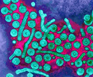Bilder Datiert 9. September 2002: Hepatitis-B-Viren, TEM