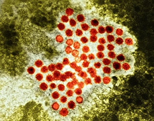 Drucke von Hepatitis A-Virus. Farbige Transmissionselektronenmikroskopaufnahme (TEM) eines Clusters von Hepatitis-A-Virenpartikeln, der Ursache für infektionsbedingte Leberschmerzen Bilder Datiert 2007 November: Viruspartikel der Hepatitisa-Viren, TEM