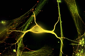 Bilder Datiert 4. Oktober 2010: Hipposammusneuron fluoreszierendes Mikrograf