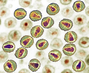 HIV-Partikel, TEM