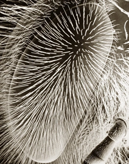 Bilder aus dem Jahr 1985: Bienchenauge