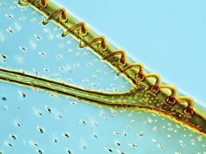 Light Microscopy Images Drucke: Honey bee wing hamuli, light micrograph