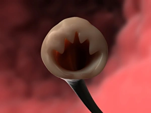 Medical Illustration Art Drucke: Hookworm head, artwork