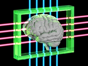 Human Brain Illustration Drucke: Human brain
