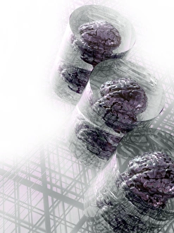 Medical Illustration Artwork Drucke: Human brains