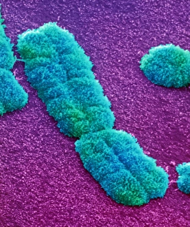 Drucke von Menschliches Chromosom. Farbiger Rasterton Mikroskop (SEM)-Bild eines menschlichen Chromosoms Bilder Datiert 2001 März: Menschliches Chromosom