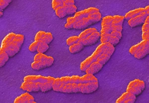 Menschliche Chromosomen