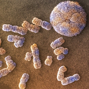 Human Chromosomes SEM Drucke: Human chromosomes and nucleus, SEM